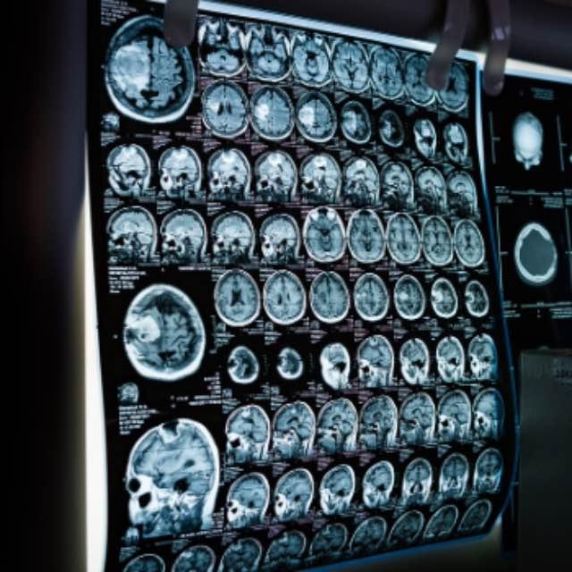 神经系统为什么要自指一个「我」出来指导肉体活动?-软件乐园