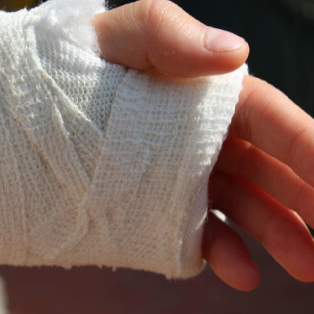 伤口愈合的时候感觉好痒怎么办?-软件乐园