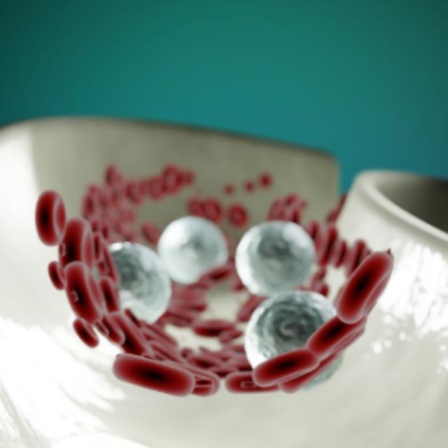 什么是动脉粥样硬化及动脉粥样化发生机制?-软件乐园